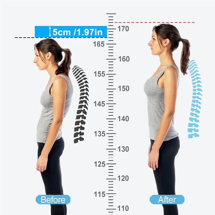 SmartPosture